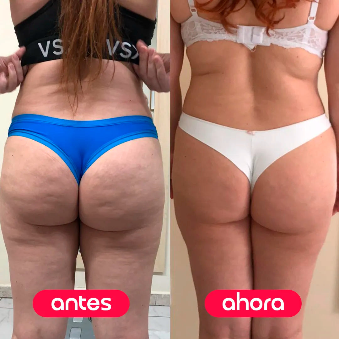 Probamos las 5 cremas postparto más populares. La ganadora nos sorprendió a todas.